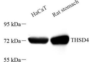 Western blot analysis of THSD4 (ABIN7075894),at dilution of 1: 2000 (Thrombospondin, Type I, Domain Containing 4 (THSD4) antibody)