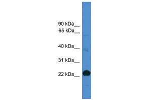 WB Suggested Anti-CD8A Antibody Titration: 0. (CD8 alpha antibody  (Middle Region))