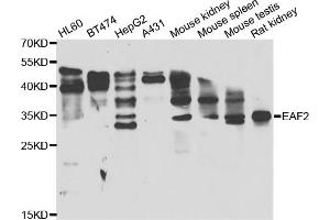Western blot analysis of extracts of various cell lines, using EAF2 antibody (ABIN5974281) at 1/1000 dilution. (EAF2 antibody)