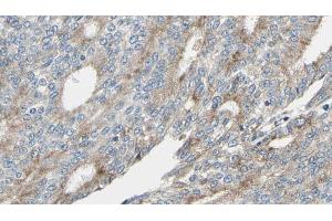 ABIN6268945 at 1/100 staining Human prostate tissue by IHC-P. (MARCKS antibody  (Internal Region))