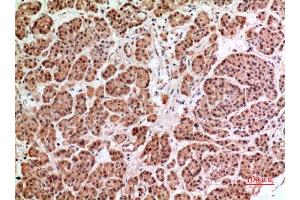 Immunohistochemistry (IHC) analysis of paraffin-embedded Human Pancreas, antibody was diluted at 1:100. (HPSE antibody  (Internal Region))