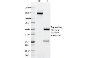 SDS-PAGE Analysis Purified AKT1 Mouse Monoclonal Antibody (AKT1/2491). (AKT1 antibody  (AA 85-189))