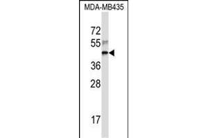 RPL3 Antibody (Center) (ABIN657323 and ABIN2846397) western blot analysis in MDA-M cell line lysates (35 μg/lane). (RPL3 antibody  (AA 224-251))