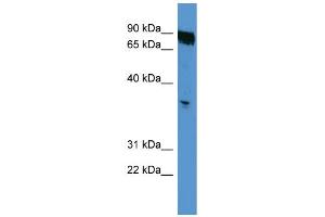WB Suggested Anti-OR2K2 Antibody Titration: 0. (OR2K2 antibody  (C-Term))