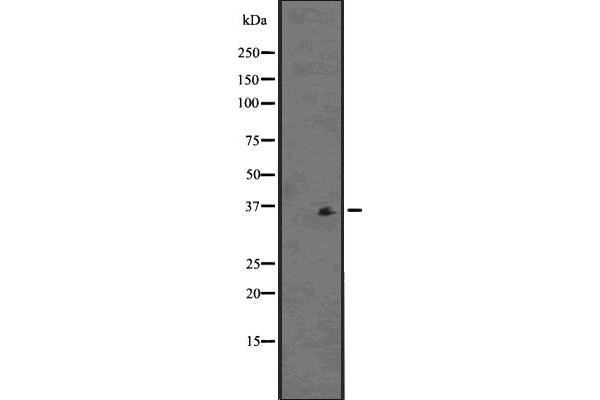 PDLIM1 antibody  (Internal Region)