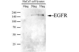Image no. 4 for anti-Epidermal Growth Factor Receptor (EGFR) (AA 424-605) antibody (ABIN782452) (EGFR antibody  (AA 424-605))