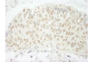 anti-Splicing Factor, Suppressor of White-Apricot Homolog (SFSWAP) (AA 500-550) antibody