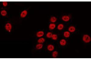 ABIN6274702 staining HeLa by IF/ICC. (RAD54L antibody  (C-Term))