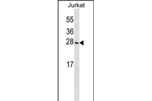 CGGBP1 Antibody (C-term) (ABIN1536689 and ABIN2849923) western blot analysis in Jurkat cell line lysates (35 μg/lane). (CGGBP1 antibody  (C-Term))