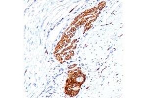 IHC testing of human colon ganglion stained with NCAM antibody (123C3. (CD56 antibody)