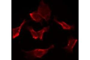 ABIN6275594 staining HepG2 by IF/ICC. (SLC5A6 antibody  (C-Term))