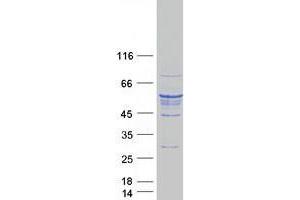 TUBB5 Protein (Myc-DYKDDDDK Tag)