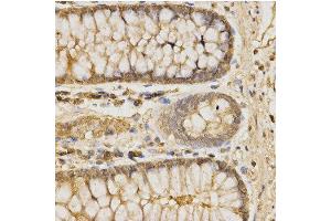 Immunohistochemistry of paraffin-embedded human colon using GLB1 antibody at dilution of 1:200 (x400 lens) (GLB1 antibody  (AA 1-270))