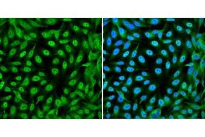 Immunofluorescence analysis of DLD-1 cells showing nuclear and cytoplasmic localization with YAP1 antibody 1:200 (left,green).