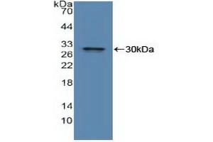 Western blot analysis of recombinant Human IDE. (IDE antibody  (AA 753-973))