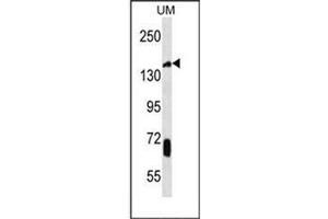Western blot analysis of JHDM2a Antibody (C-term) in UM cell line lysates (35ug/lane). (KDM3A antibody  (C-Term))