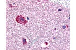 Immunohistochemical (Formalin/PFA-fixed paraffin-embedded sections) staining in human brain (caudate) with GPR61 polyclonal antibody . (GPR61 antibody)