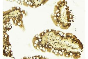 ABIN6267480 at 1/100 staining Mouse colon tissue by IHC-P. (CTNNB1 antibody  (pTyr489))