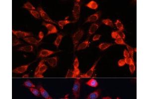Immunofluorescence analysis of NIH-3T3 cells using MRPS28 Polyclonal Antibody at dilution of 1:100 (40x lens).
