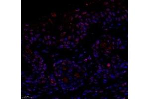 Immunofluorescence of paraffin embedded mouse skin using notch3 (ABIN7074862) at dilution of 1:650 (400x lens) (NOTCH3 antibody)