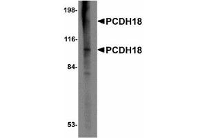 Image no. 1 for anti-Protocadherin 12 (PCDH12) (N-Term) antibody (ABIN478055)