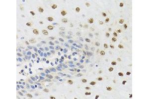 Immunohistochemistry of paraffin-embedded Human esophagus using YTHDF3 Polyclonal Antibody at dilution of 1:100 (40x lens). (YTHDF3 antibody)