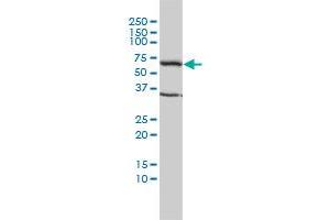 TCP1 monoclonal antibody (M01), clone 2B2-D6 Western Blot analysis of TCP1 expression in Hela . (TCP1 alpha/CCTA antibody  (AA 1-556))