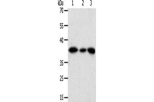 Western Blotting (WB) image for anti-Aldo-Keto Reductase Family 1, Member A1 (Aldehyde Reductase) (AKR1A1) antibody (ABIN2426542) (AKR1A1 antibody)