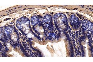 Detection of FUR in Mouse Colon Tissue using Polyclonal Antibody to Furin (FUR) (FURIN antibody  (AA 418-573))
