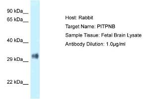 Host: Rabbit Target Name: PITPNB Sample Type: Fetal Brain lysates Antibody Dilution: 1. (PITPNB antibody  (N-Term))