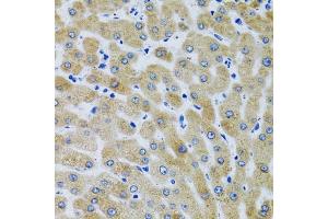 Immunohistochemistry of paraffin-embedded Human liver using MBL2 antibody (ABIN6132334, ABIN6143597, ABIN6143600 and ABIN6221519) at dilution of 1:100 (40x lens).