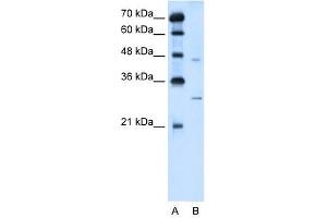 SLC36A3 antibody used at 5 ug/ml to detect target protein.