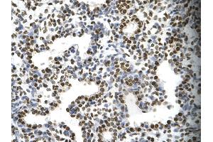 Immunohistochemistry (IHC) image for anti-FOS-Like Antigen 1 (FOSL1) (Middle Region) antibody (ABIN2777265)