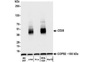 Western Blotting (WB) image for anti-CD28 (CD28) (AA 170-220) antibody (ABIN7455122) (Recombinant CD28 antibody  (AA 170-220))