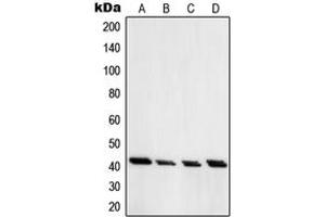 Western blot analysis of PRKAR1A expression in Jurkat (A), HT29 (B), H1299 (C), A549 (D) whole cell lysates.