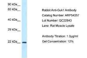Western Blotting (WB) image for anti-Guanylate Kinase 1 (GUK1) (N-Term) antibody (ABIN2785668) (GUK1 antibody  (N-Term))