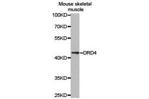 Western Blotting (WB) image for anti-Dopamine Receptor D4 (DRD4) antibody (ABIN1872359) (DRD4 antibody)