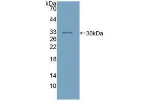 Detection of Recombinant calretinin, Human using Polyclonal Antibody to Calretinin (CR) (Calretinin antibody  (AA 28-248))