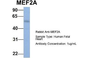 Host: Rabbit Target Name: MEF2A Sample Type: Human Fetal Heart Antibody Dilution: 1. (MEF2A antibody  (N-Term))