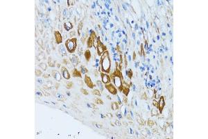 Immunohistochemistry of paraffin-embedded human esophagus using PSRC1 antibody (ABIN5973194) at dilution of 1/100 (40x lens). (PSRC1 antibody)