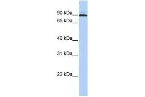 WB Suggested Anti-PEO1 Antibody Titration:  0. (C10orf2 antibody  (Middle Region))