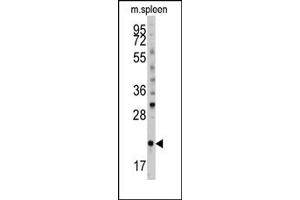 Image no. 1 for anti-BH3 Interacting Domain Death Agonist (BID) (pSer61) antibody (ABIN356817) (BID antibody  (pSer61))
