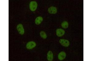 Immunocytochemistry stain of Hela using DNA-PKcs mouse mAb (1:100). (PRKDC antibody)