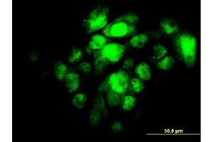 Immunofluorescence of monoclonal antibody to IRF5 on A-431 cell. (IRF5 antibody  (AA 395-504))