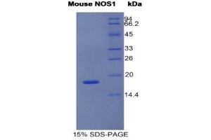 SDS-PAGE (SDS) image for Nitric Oxide Synthase 1, Neuronal (NOS1) (AA 691-826) protein (His tag) (ABIN1980839) (NOS1 Protein (AA 691-826) (His tag))