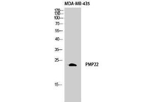 Western Blotting (WB) image for anti-Peripheral Myelin Protein 22 (PMP22) (C-Term) antibody (ABIN3184742) (PMP22 antibody  (C-Term))