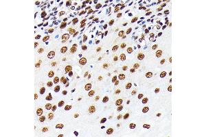 Immunohistochemistry (IHC) image for anti-ELAV (Embryonic Lethal, Abnormal Vision, Drosophila)-Like 1 (Hu Antigen R) (ELAVL1) antibody (ABIN7266913)