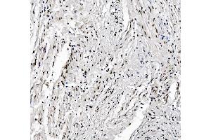 IHC analysis of FOXK1 using anti-FOXK1 antibody (ABIN7600295). (Foxk1 antibody  (AA 175-671))