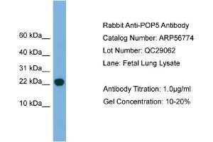 WB Suggested Anti-POP5  Antibody Titration: 0. (POP5 antibody  (Middle Region))
