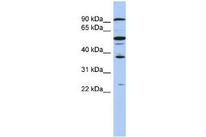 WB Suggested Anti-EZH1 Antibody Titration:  0. (EZH1 antibody  (N-Term))